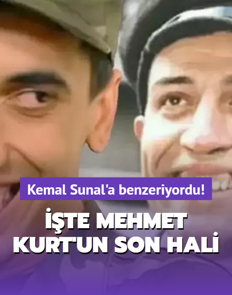 Kemal Sunal'a benzerli�i ile tan�nd�: Mehmet Kurt'un son hali g�renleri �a��rtt�