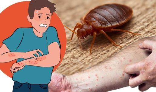 Kanla besleniyorlar! Her yerde bu böcekler var! İlk belirti: Kaşıntı ve ciltte kızarıklık