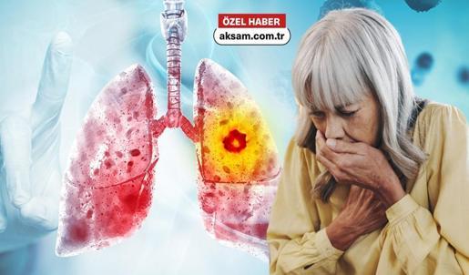 Uzmanı uyardı: Akciğerler tehlikede, kanser kapıda! Dumansız diye herkesin elinde ama...