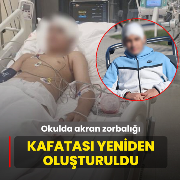 Okulda akran zorbal���! Kafatas� yeniden olu�turuldu