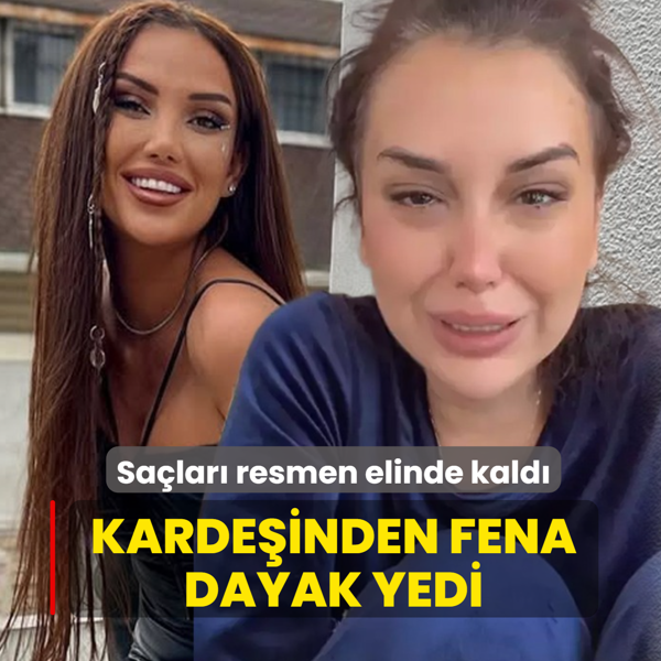 Karde�inden fena dayak yedi! Sa�lar� resmen elinde kald�...
