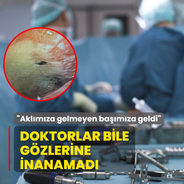 Doktorlar bile g�zlerine inanamad�! Akl�m�za gelmeyen ba��m�za geldi